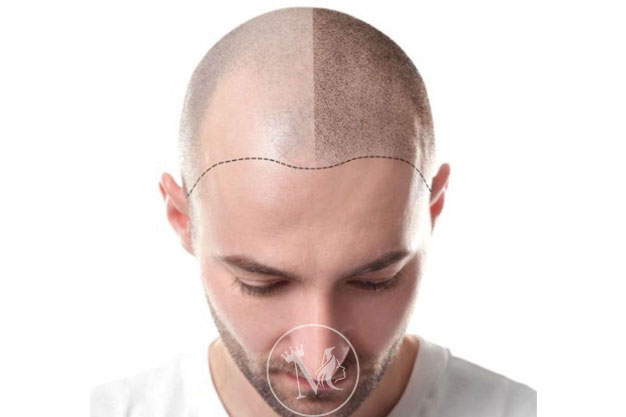 Mumbai Permanent Makeup Studio